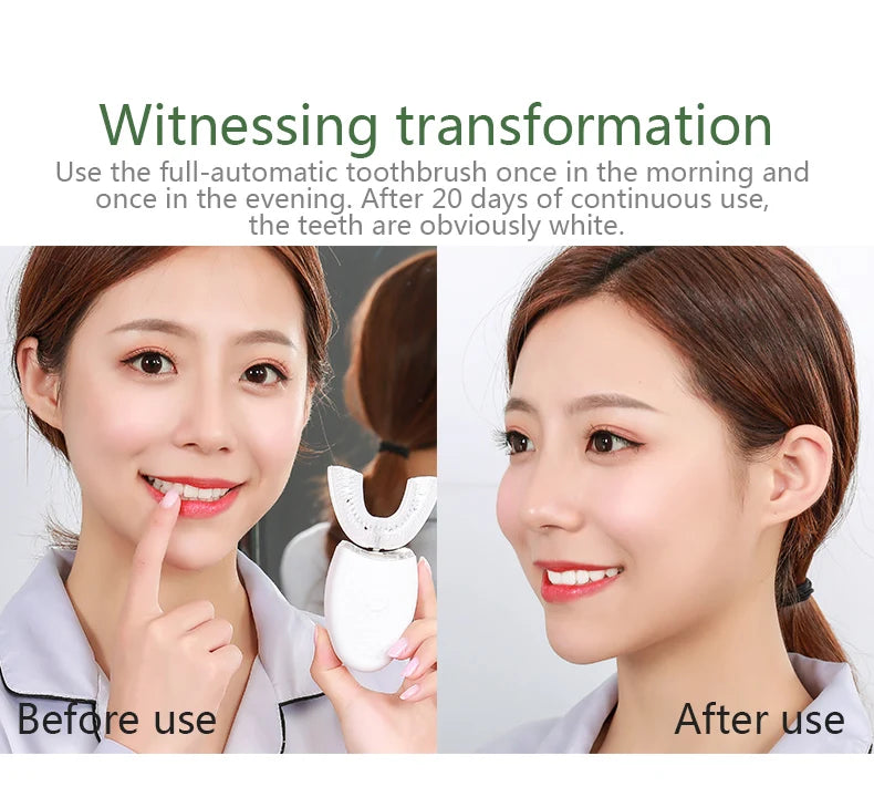 ORAVIBE™ 360 Smart U-Shape Sonic Toothbrush
